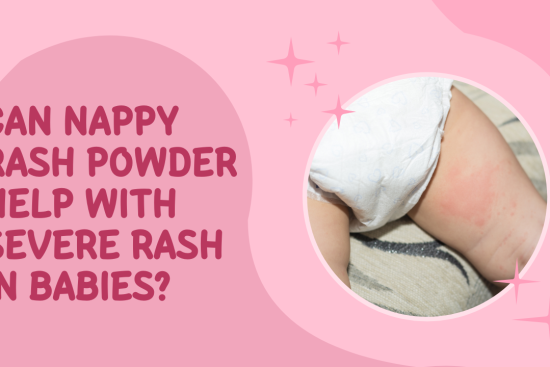 Can Nappy Rash Powder Help with Severe Rash in Babies