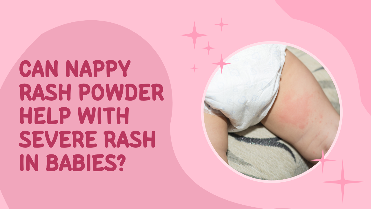 Can Nappy Rash Powder Help with Severe Rash in Babies