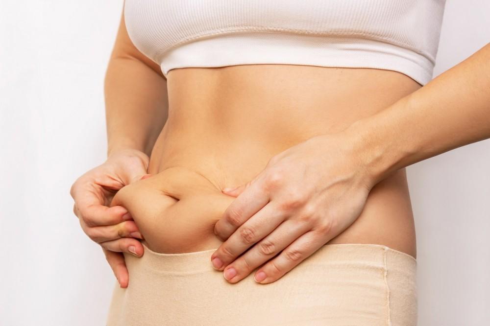 Liposuction Surgery in Dubai