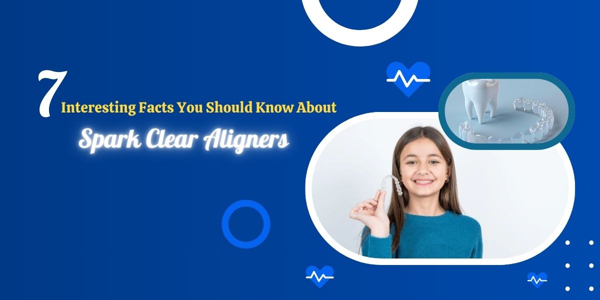 7 Interesting Facts You Should Know About Spark Clear Aligners